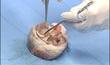 CHU : Nouvelles salles de plastination